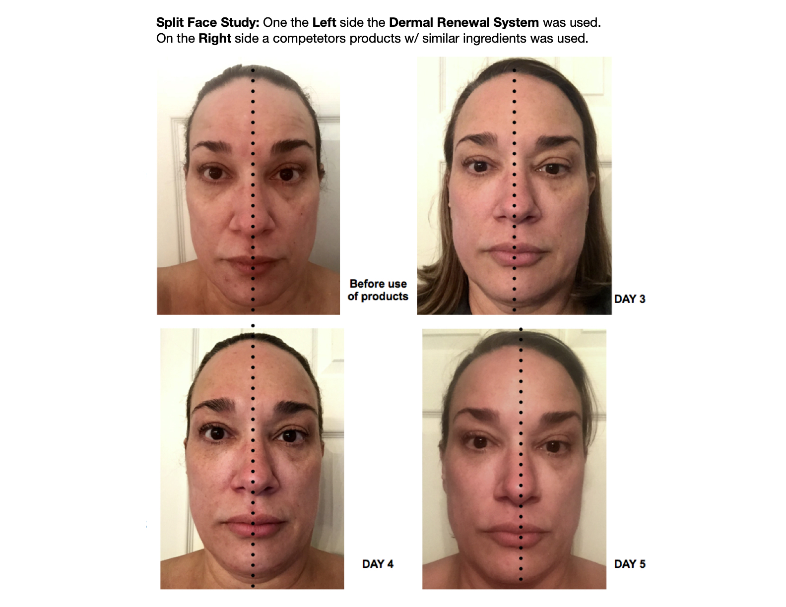 Before and after skincare results